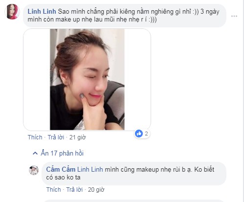 Sau khi nâng mũi nên nằm hay ngồi ? Những Review thực tế nhất - Hình 7