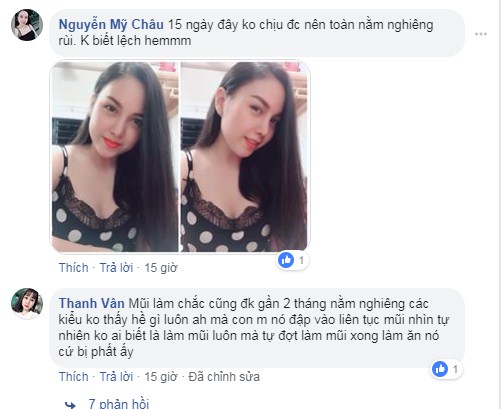 Sau khi nâng mũi nên nằm hay ngồi ? Những Review thực tế nhất - Hình 8