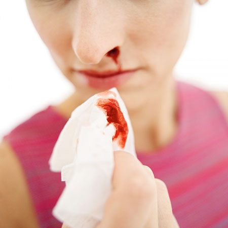 Nâng mũi ăn mì tôm được không? 3 Nguy cơ tiềm ẩn ở trong gói mì - Hình 2