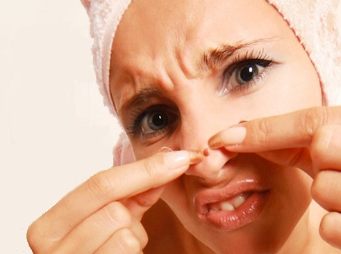 Nâng mũi ăn mì tôm được không? 3 Nguy cơ tiềm ẩn ở trong gói mì - Hình 4