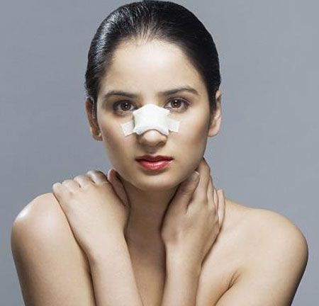 Nâng mũi bao lâu thì lành ? 3 Cách giúp mũi bạn Hồi Phục Nhanh hơn - Hình 1