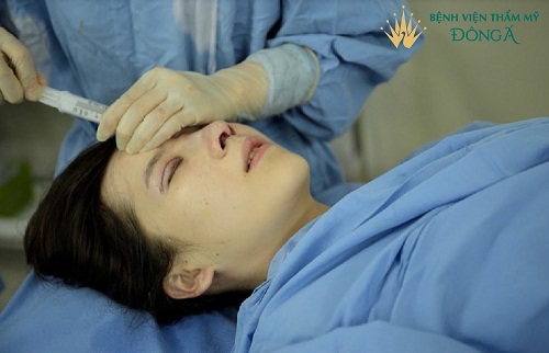Hút dịch sau khi nâng mũi | Giải đáp 7 Thắc Mắc phổ biến nhất - Hình 4