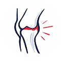 Tendon Irritation
