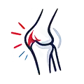 Runner’s Knee