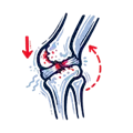 Progressive Joint Damage or Deformity