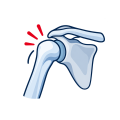 Shoulder joint illustration representing clicking during movement