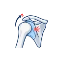 Illustration of a stiff shoulder joint capsule.