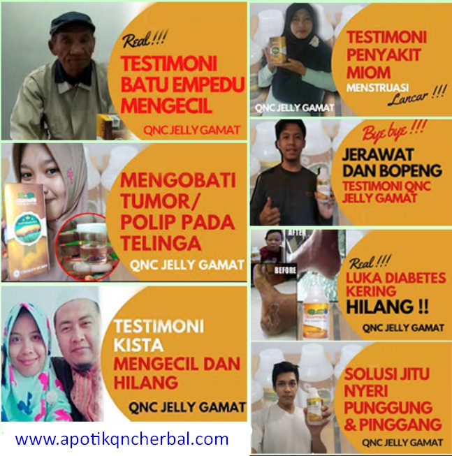 Inilah 5 Cara Mengatasi Demam Anak Secara Alami