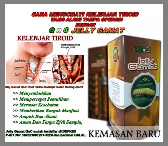 Cara Tradisional Mengobati Penyakit Kelenjar Tiroid Sembuh Tanpa Di Operasi