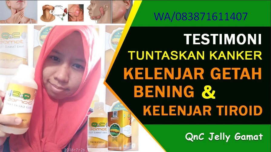 Cara Tradisional Mengobati Penyakit Kelenjar Tiroid Sembuh Tanpa Di Operasi