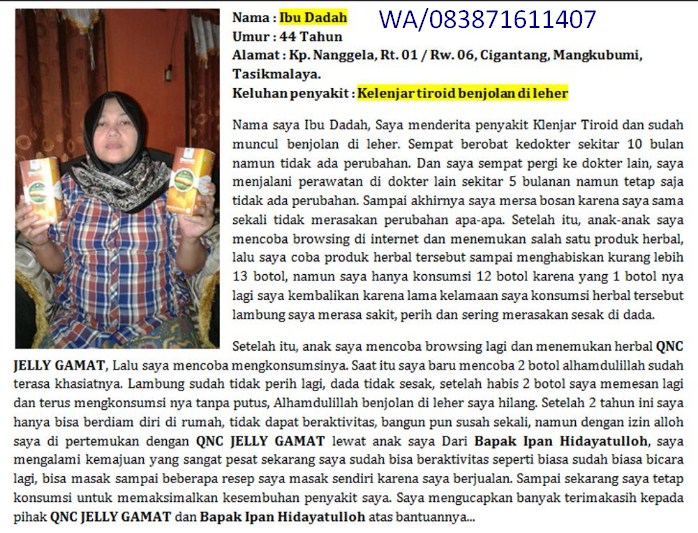 Cara Tradisional Mengobati Penyakit Kelenjar Tiroid Sembuh Tanpa Di Operasi