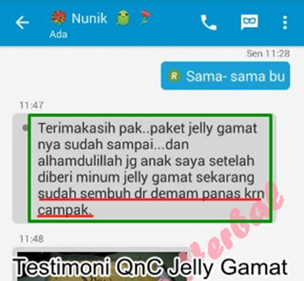 Inilah 5 Cara Mengatasi Demam Anak Secara Alami