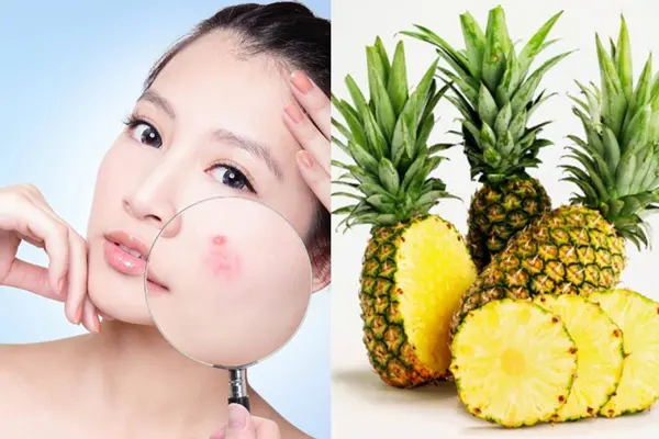 Ăn dứa có tác dụng gì với nữ giới? - Tăng cường hệ miễn dịch