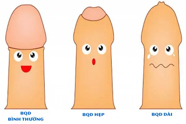 Các bệnh lý về bao quy đầu