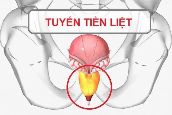 Các bệnh lý về tuyến tiền liệt