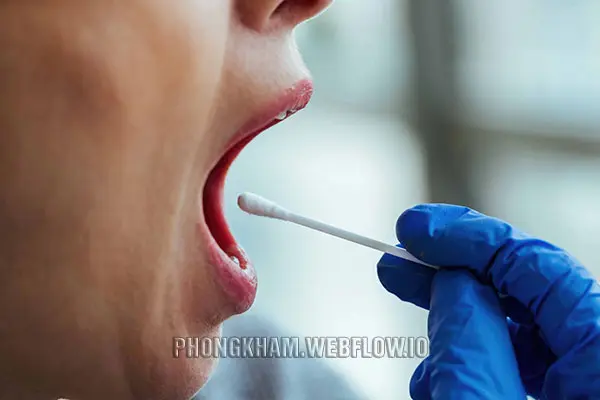 Cách điều trị bệnh giang mai ở miệng, lưỡi đúng cách