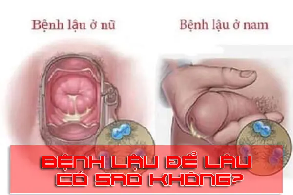 Bệnh lậu là gì? Nguyên nhân gây ra bệnh lậu