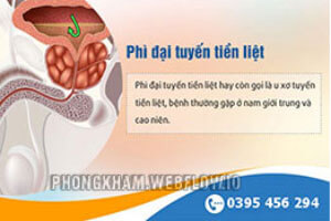 Bệnh phì đại tuyến tiền liệt là gì? có nguy hiểm không?