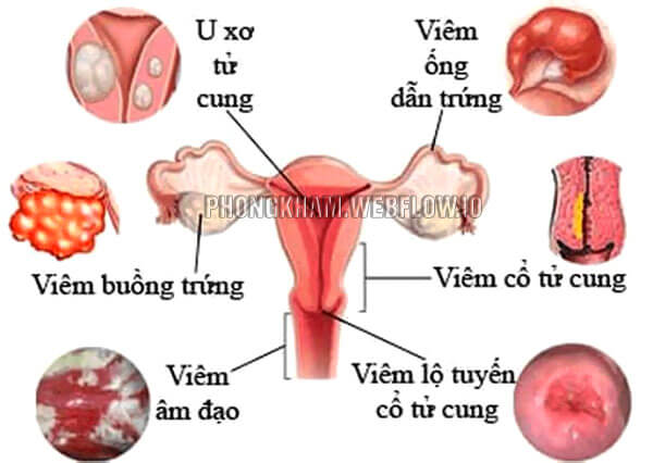 TOP 10+ Bệnh phụ khoa nữ giới thường mắc nên đi khám sớm