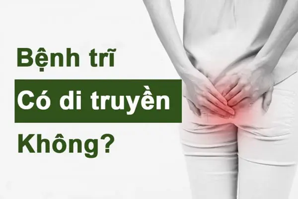 Chuyên gia giải đáp: Bệnh trĩ có di truyền hay không?