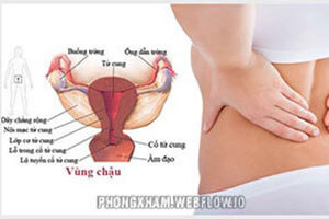 Bệnh viêm vùng chậu là gì, dấu hiệu triệu chứng cách phòng bệnh