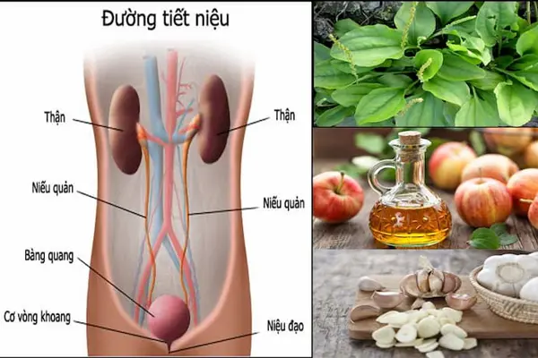Cách điều trị viêm đường tiết niệu ở nam giới đơn giản tại nhà