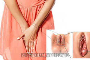 Bị sưng vùng kín (môi lớn, môi bé) nguyên nhân cách khắc phục