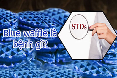 Blue waffle là gì? (Bánh quế xanh) Nó có thật sự tồn tại hay không?