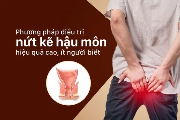 15 Cách chữa trị nứt kẽ hậu môn tại nhà hiệu quả nhất