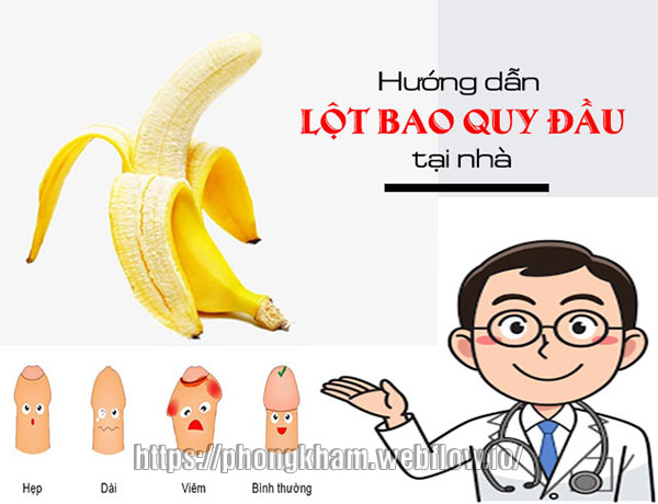 Cách lột bao quy đầu tại nhà hiệu quả hay được áp dụng như sau
