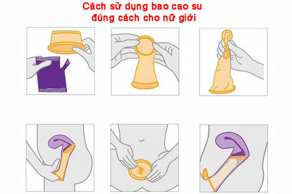 Hướng dẫn dùng bao cao su đúng cách cho nữ giới