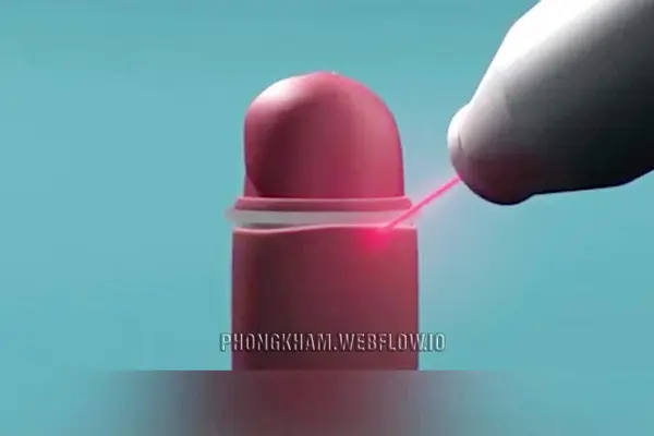 Cắt bao quy đầu bằng laser ưu nhược điểm các bước thực hiện