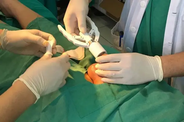 Cắt bao quy đầu bằng máy ở đâu an toàn, chi phí hợp lý - Phòng khám nam khoa Hưng Thịnh