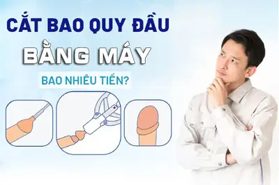 Cắt bao quy đầu bằng máy giá bao nhiêu? BẢNG GIÁ 2025