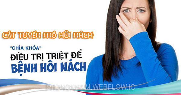 Yếu tố ảnh hưởng đến chi phí cắt tuyến mồ hôi nách