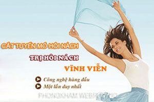 Cắt tuyến mồ hôi nách bao nhiêu tiền ở đâu Bệnh viện nào TỐT NHẤT