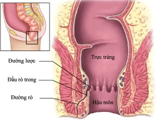 Địa chỉ y tế quyết định đến chi phí chữa rò hậu môn