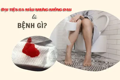 Đại tiện ra máu nhưng không đau là bị bệnh gì?