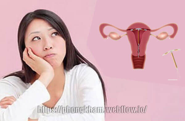 Đặt vòng tránh thai hết bao nhiêu tiền?