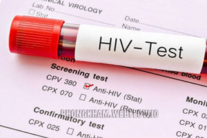 Xét nghiệm HIV ở đâu chính xác nhất TOP 6 Địa chỉ tốt và an toàn Tại Hà Nội