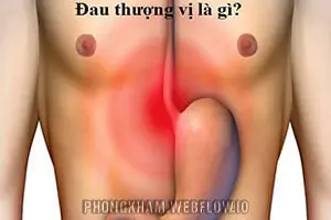 Đau thượng vị là gì? triệu chứng, nguyên nhân và mẹo chữa trị
