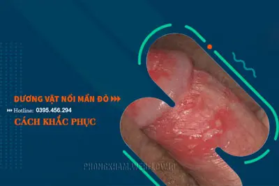 Dương vật bị nổi mẩn đỏ hình ảnh nguyên nhân cách khắc phục hiệu quả nhất