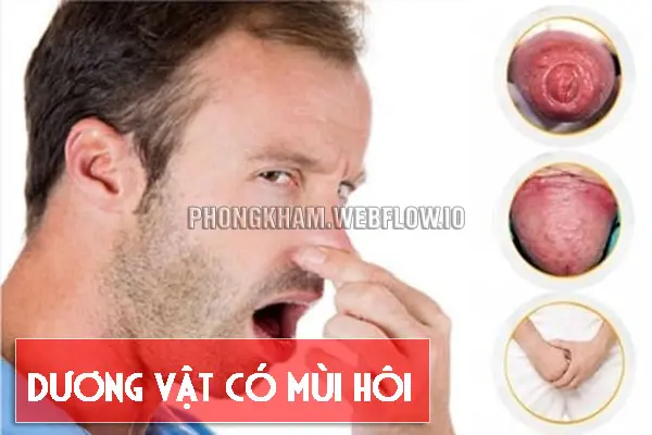 Dương vật có mùi hôi là bệnh gì, nguyên nhân cách chữa hiệu quả