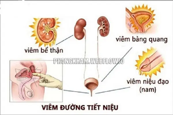 Dương vật có mùi hôi do nhiễm trùng đường tiết niệu