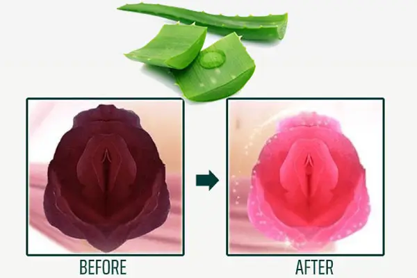 Làm hồng cô bé tự nhiên với nha đam (lô hội)