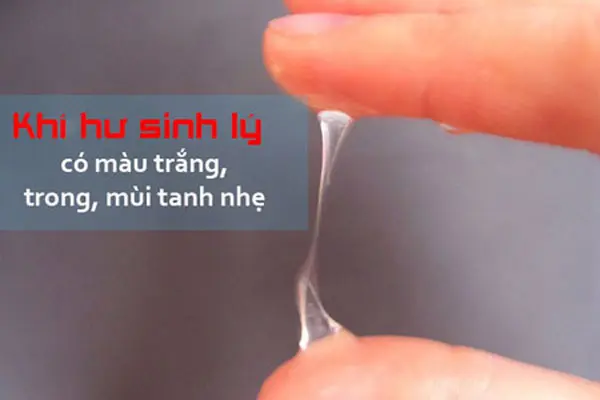 Hình ảnh khí hư màu trắng sữa là khí hư sinh lý