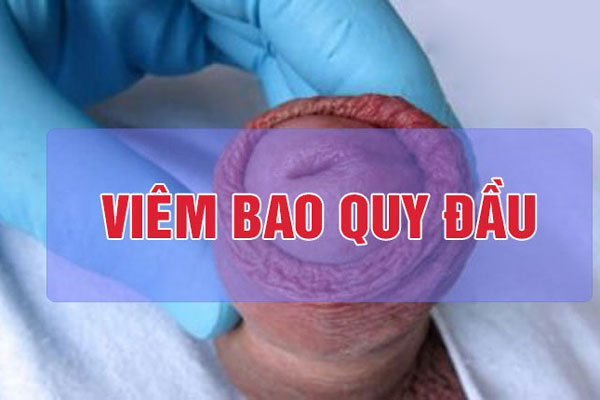 Hình ảnh ngứa ở vùng kín nam giới do viêm nhiễm bao quy đầu