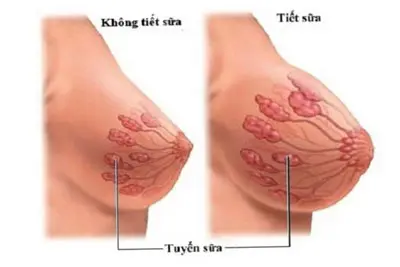 Hình ảnh nhũ hoa khi mang thai thực tế trên người thật