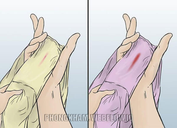 Cách khắc phục hiệu quả tình trạng ra khí hư có 1 ít sợi máu