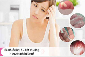 Khí hư là gì? Khi nào khí hư bất thường cần đi khám?